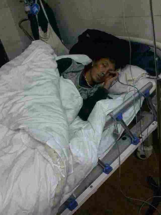A Tibetan woman who was seriously wounded by the police brutalities, at a nearby hospital.